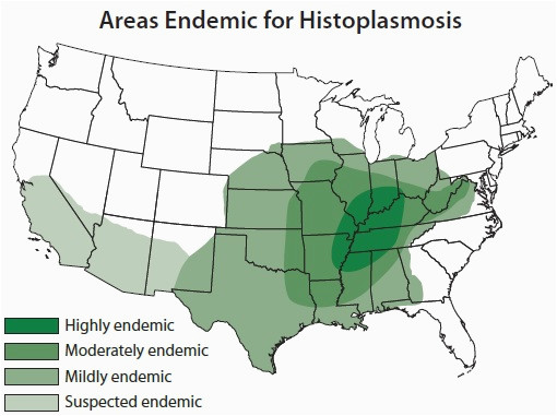histoplasmosis the scourge of the ohio river valley precision
