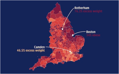 england s obesity hotspots how does your area compare